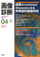 画像診断『画像診断２０２４年４月号　Ｖｏｌ．４４　Ｎｏ．５　頭部のＣｏｍｍｏｎ　ｄｉｓｅａｓｅにみる非典型的画像所見』